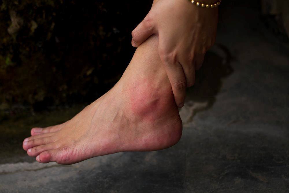 How To Treat Tendonitis On Top Of Foot 