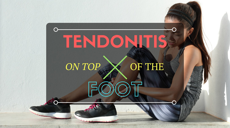 How To Treat Tendonitis On Top Of Foot With These Easy-To-Do Treatments