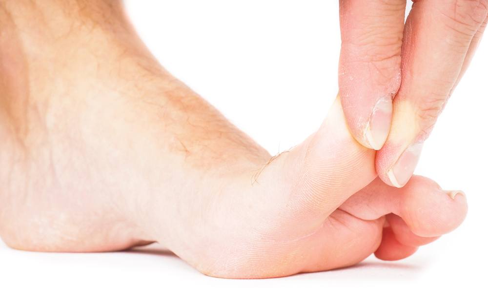 how-to-ease-pain-on-outside-of-foot-with-home-remedies